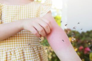 Insect Venom Allergy